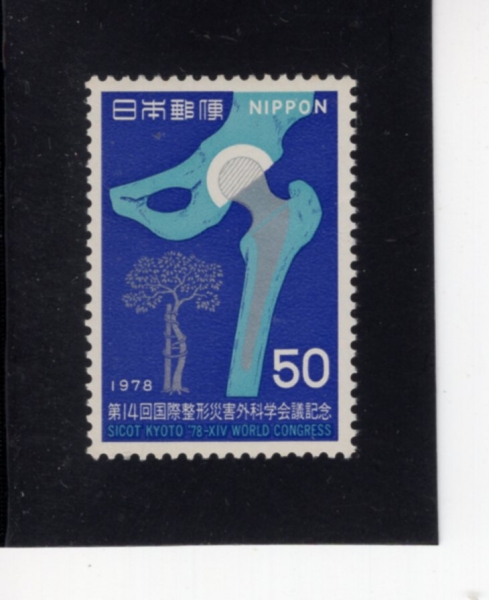 JAPAN(Ϻ)-#1349-50y-ARTIFICIAL HIP, ORTHOPEDISTS\