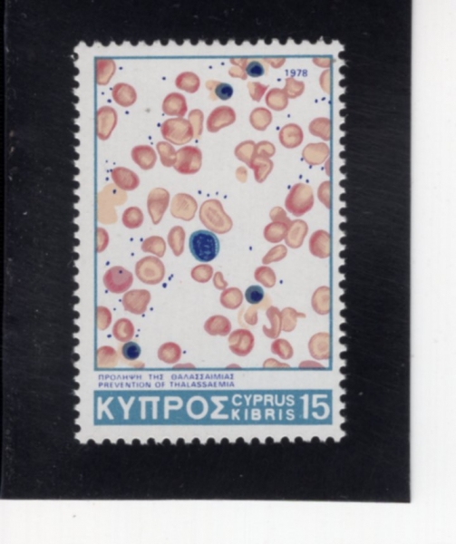 CYPRUS(Ű���ν�)-#504-15m-BLOOD CELLS WITH LOW HEMOGLOBIN(������, ���۷κ�)-1978.10.23��